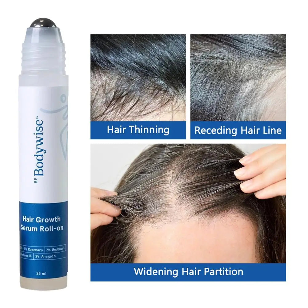 Revitalize Your Hair with 25ml Rosemary Hair Growth Roller Essence - Strengthen, Nourish, and Reduce Breakage!